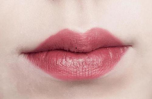 吃网纹瓜嘴唇麻木,嘴唇麻木的奇妙体验